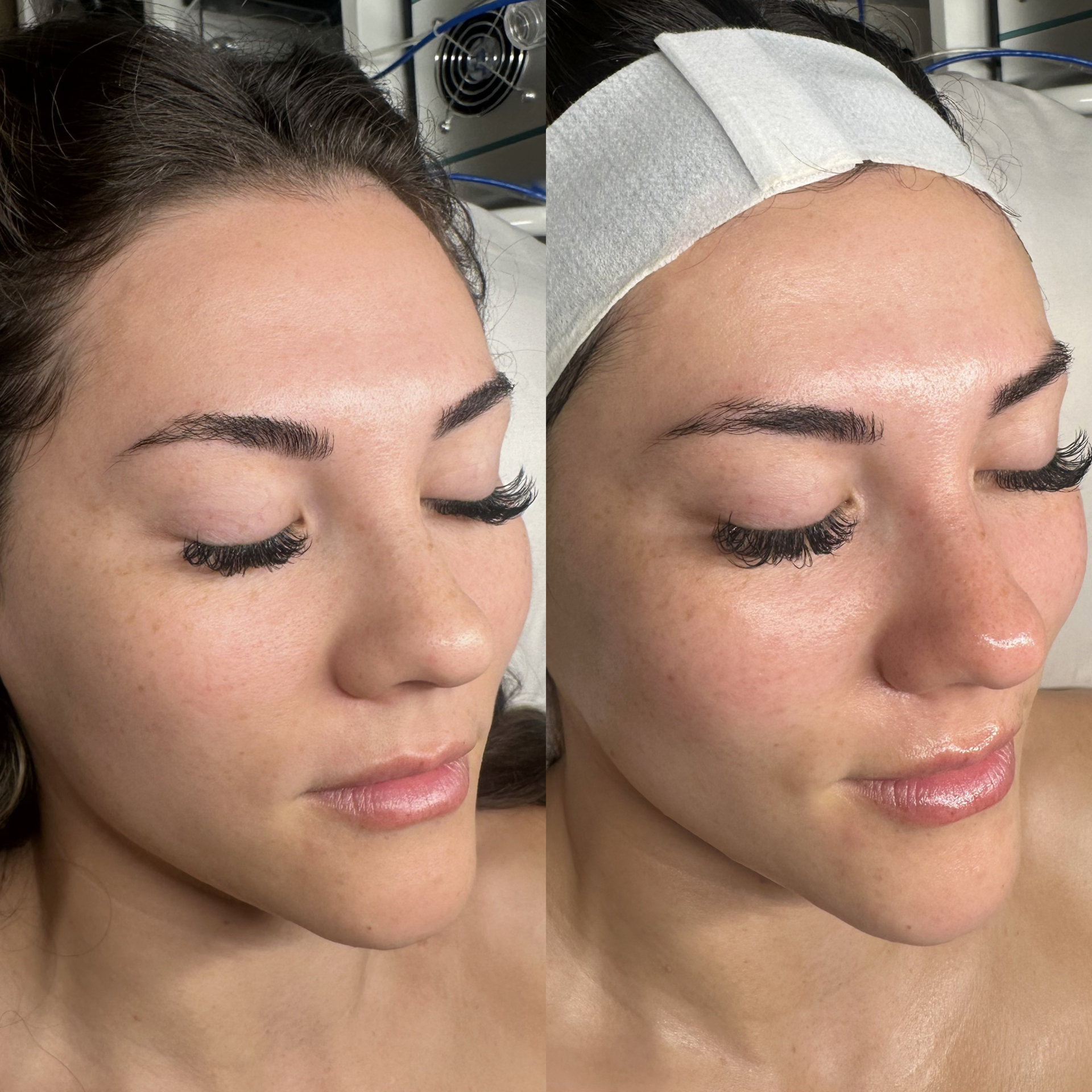 Facial before and after at Maison Kieu Beauté