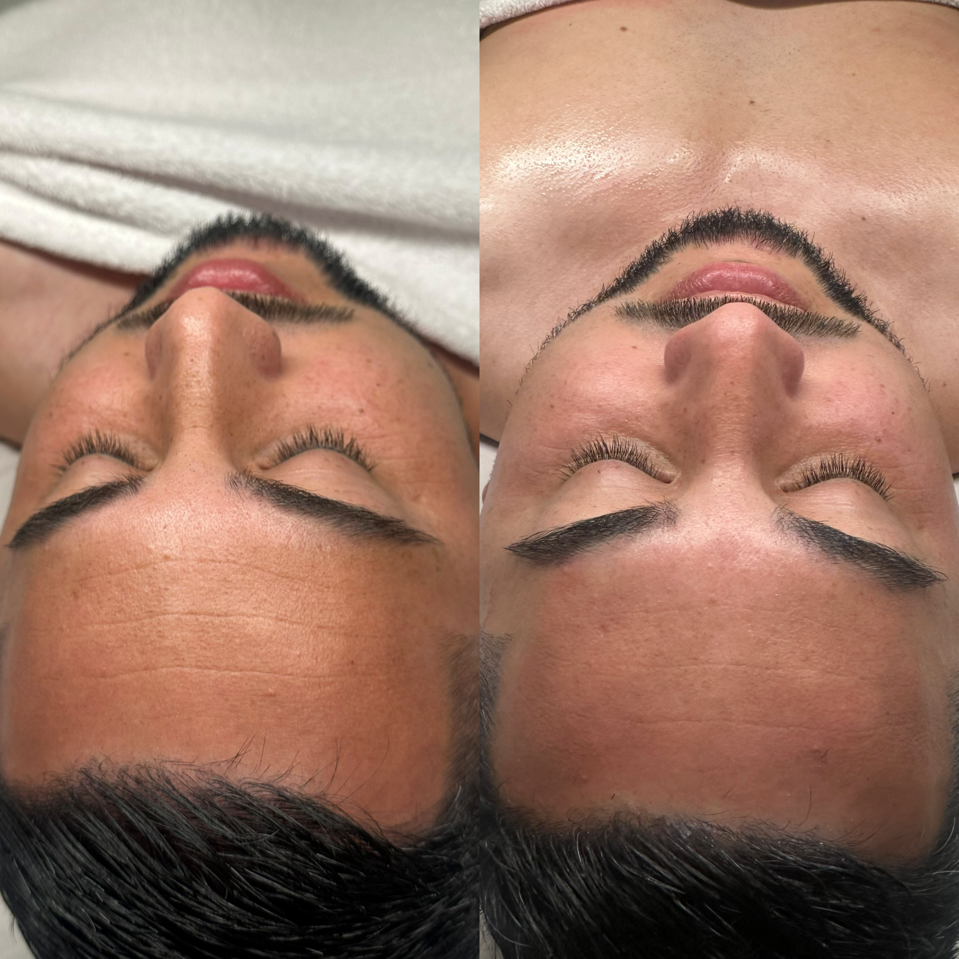 Facial before and after at Maison Kieu Beauté