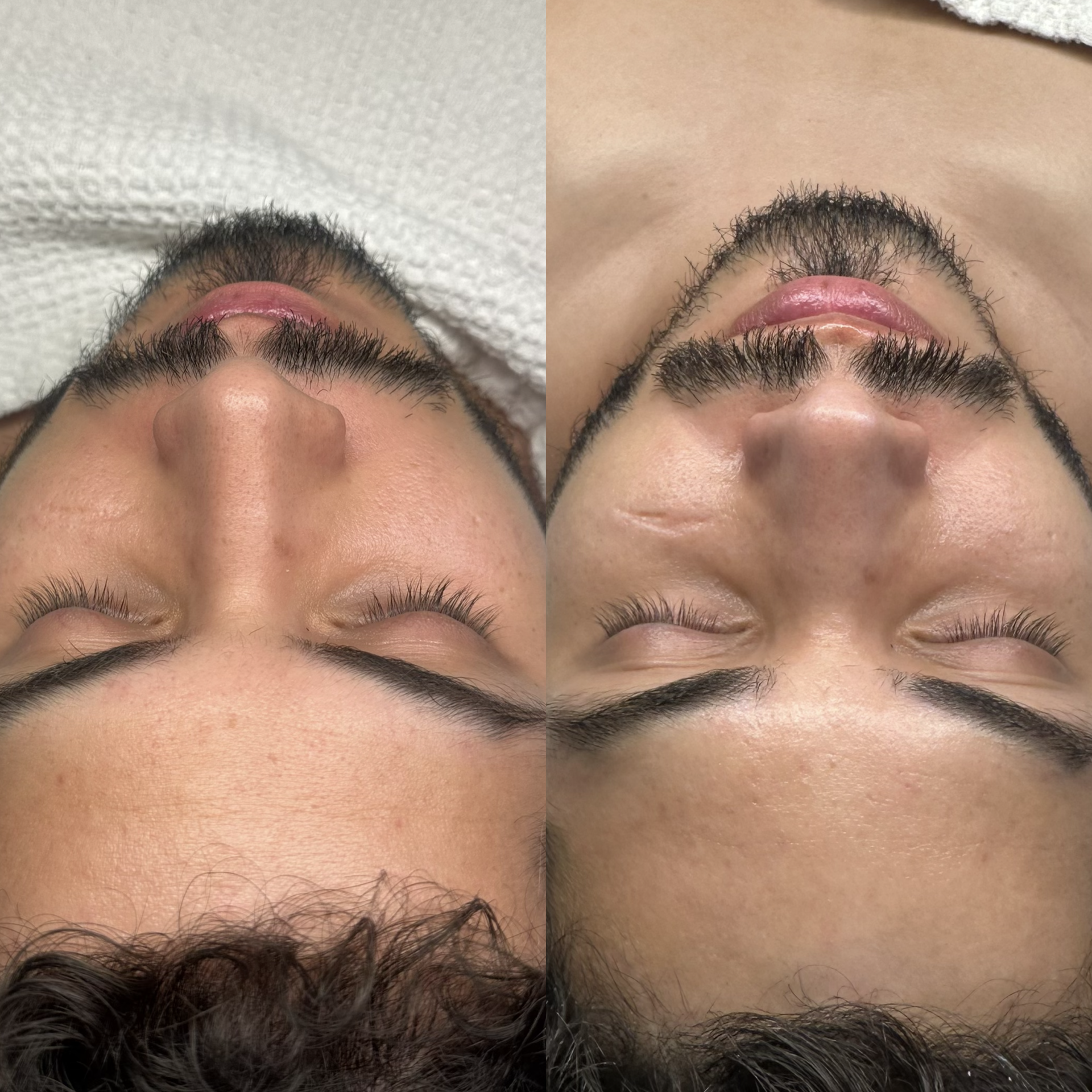 Facial before and after at Maison Kieu Beauté