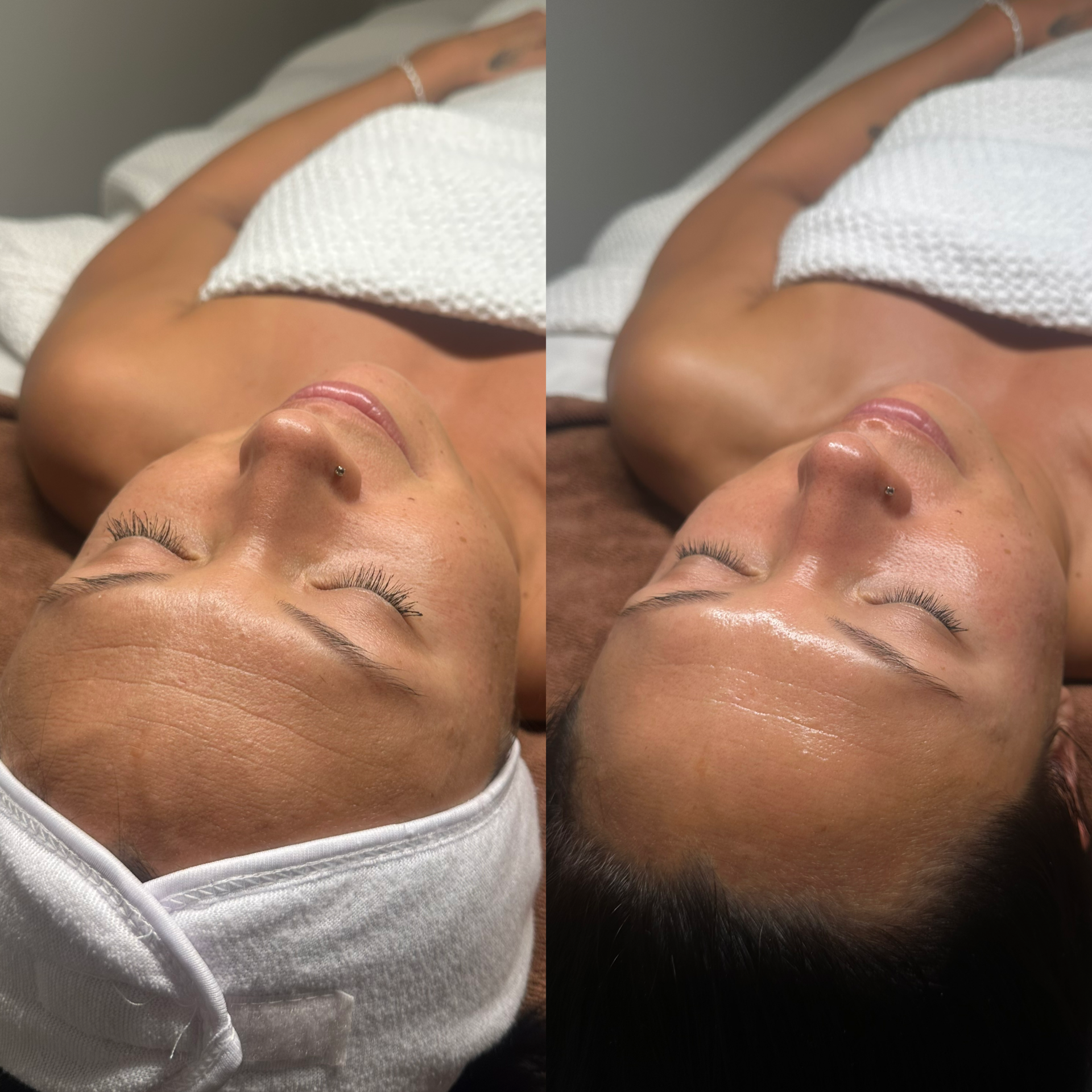 Facial before and after at Maison Kieu Beauté