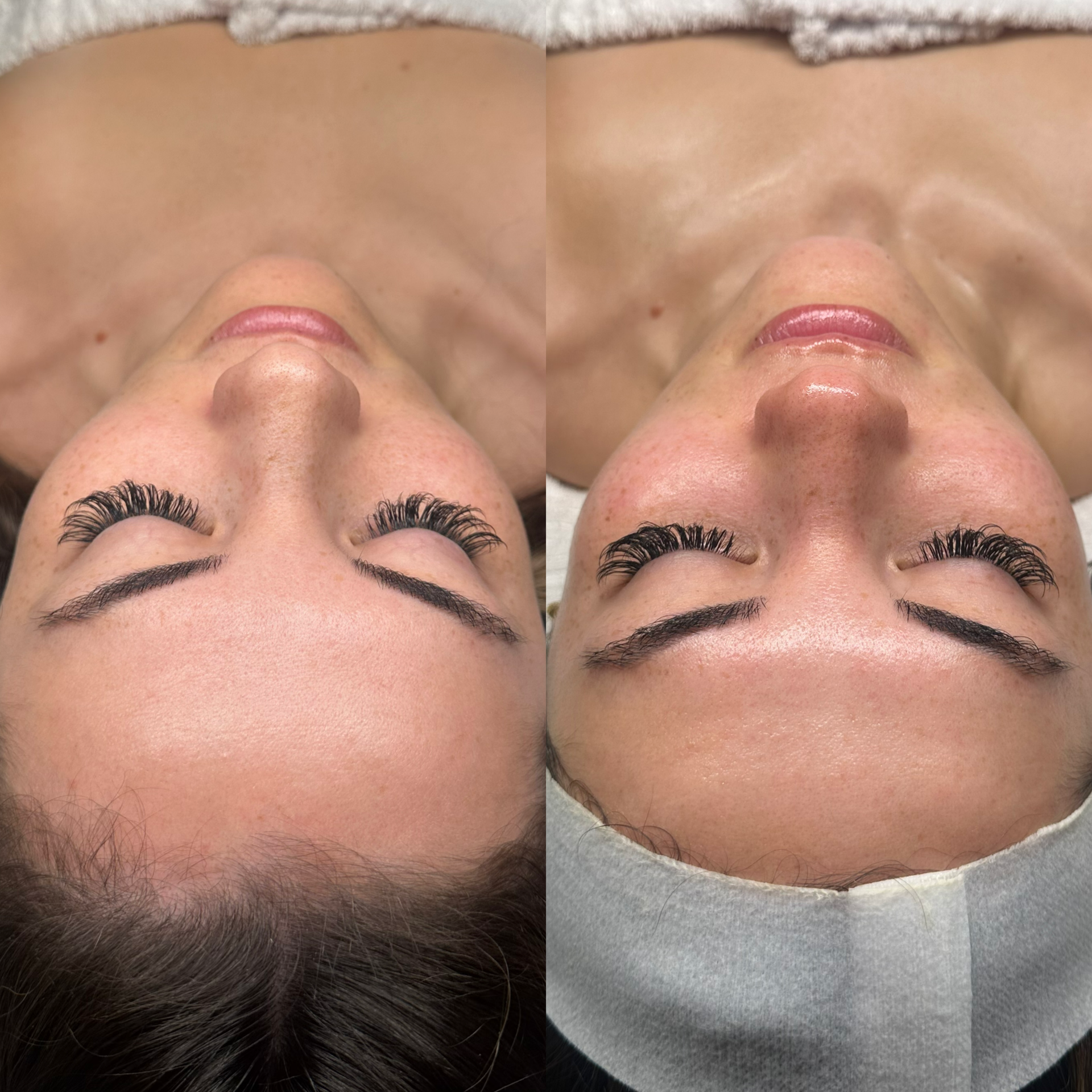 Facial before and after at Maison Kieu Beauté